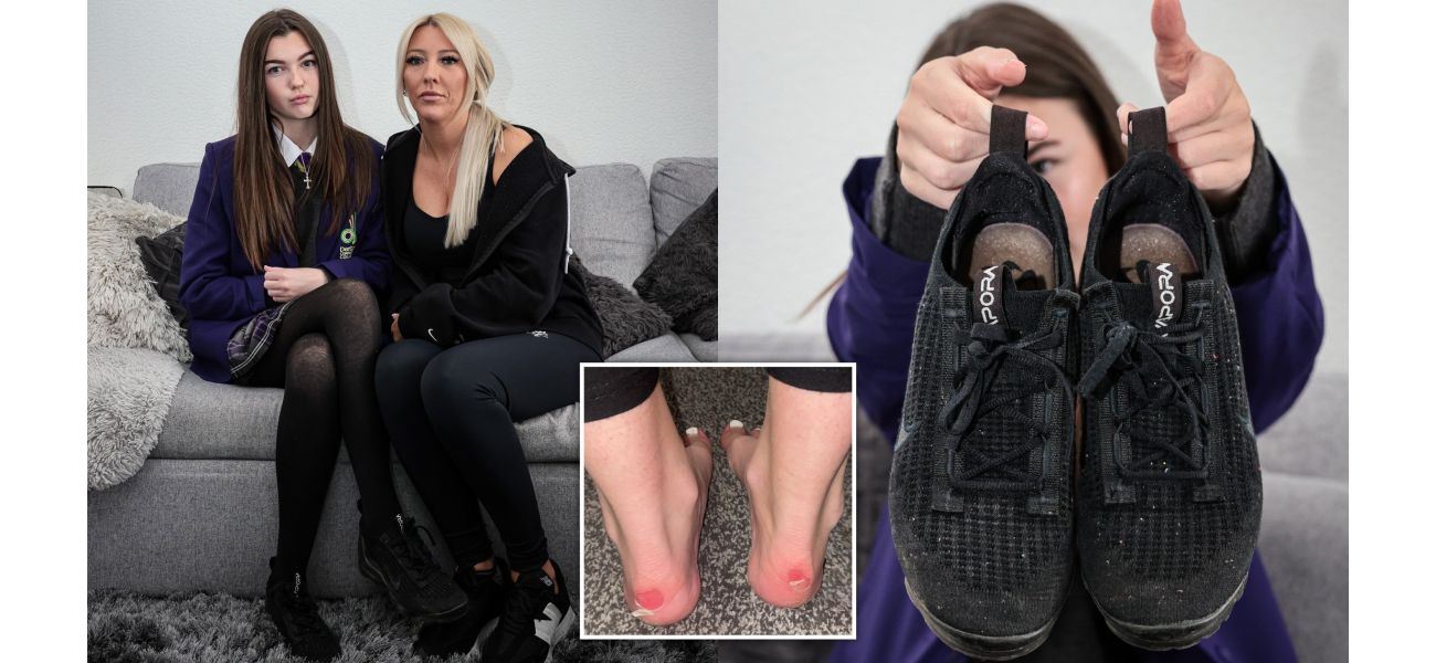 A 13-year-old girl got suspended from school due to blisters caused by her shoes.
