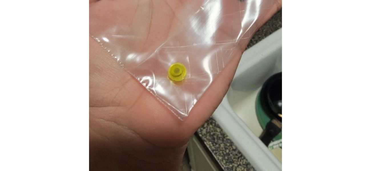 A LEGO enthusiast blows his nose and expels a brick that had been lodged in his nasal cavity for over two decades.
