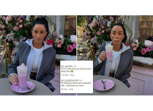 Katie Price's latest facelift results worry fans.