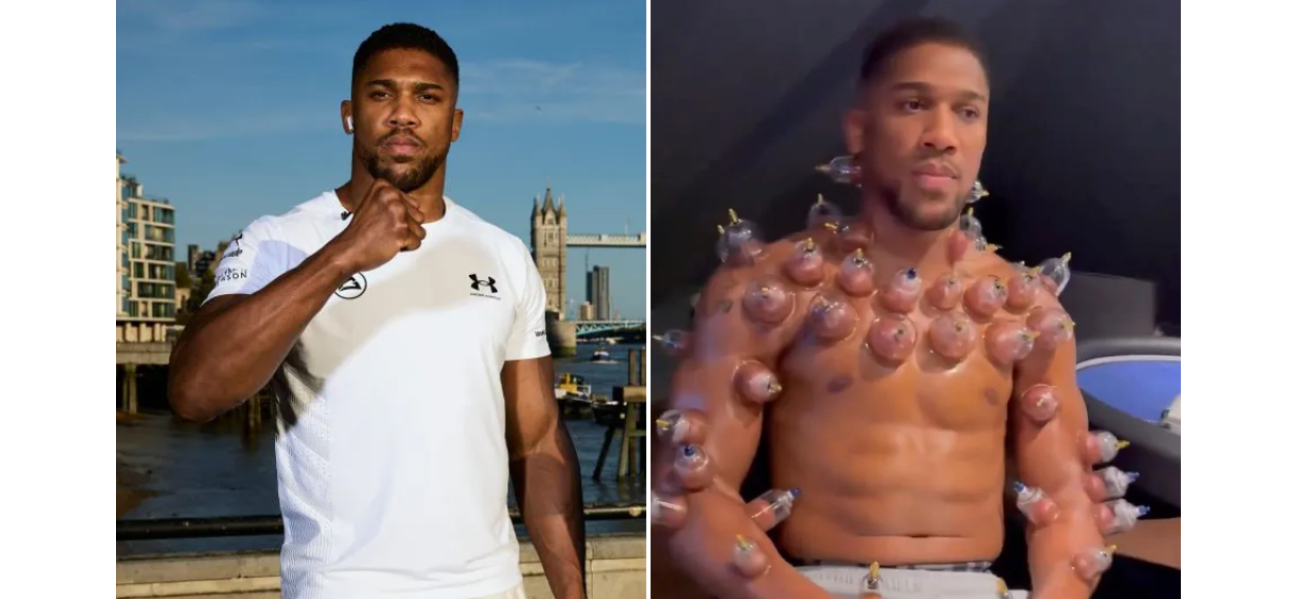 Boxer Anthony Joshua clarifies confusing cupping therapy video that caused stir among fans.