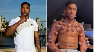 Boxer Anthony Joshua clarifies confusing cupping therapy video that caused stir among fans.