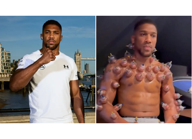Boxer Anthony Joshua clarifies confusing cupping therapy video that caused stir among fans.