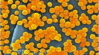 A study predicts that by 2050, superbugs may cause the death of around 40 million individuals.