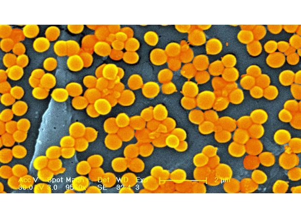 A study predicts that by 2050, superbugs may cause the death of around 40 million individuals.