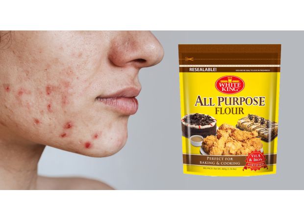 Flour recalled due to acne medicine contamination.