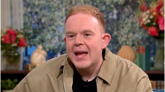 A 25-year-old Coronation Street actor displays hair transplant at 22 due to hair loss.
