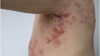 Australian citizens can now obtain a complimentary shingles vaccine.