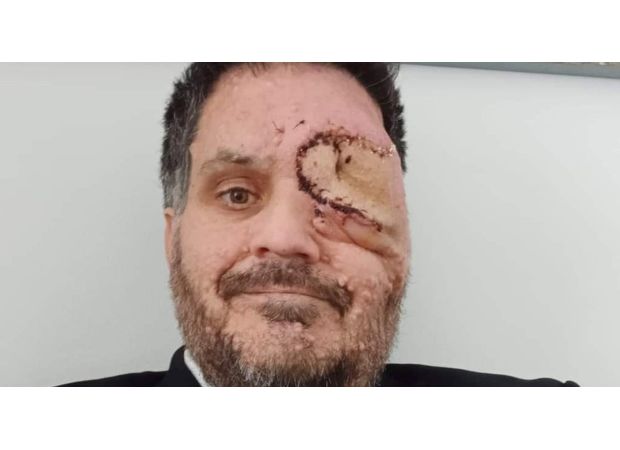 A man with a facial disfigurement was asked to leave a restaurant because his appearance was making other customers uncomfortable.