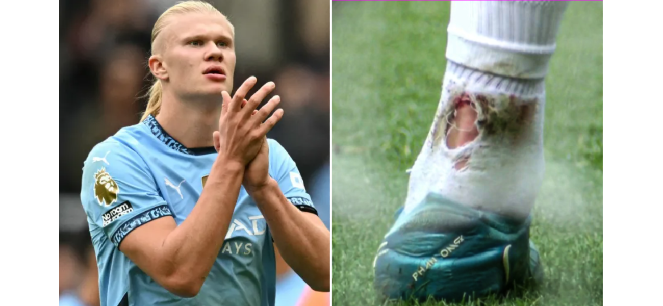 Man City manager Pep Guardiola gives an update on Erling Haaland's injury status after the striker failed to score in a recent match.