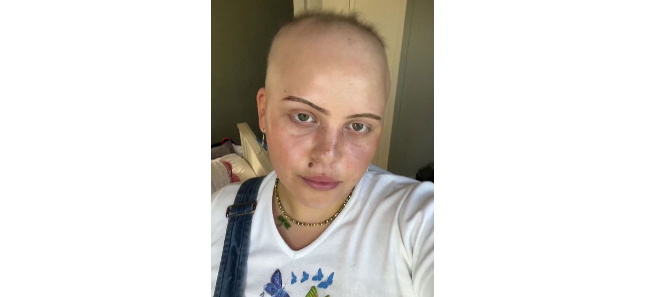Repeated Covid infections lead to woman's complete hair loss.