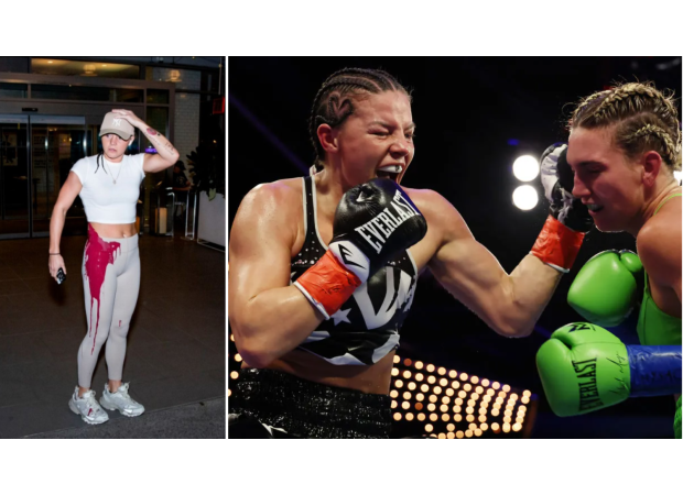 A UK boxer was splattered with red paint after being hit by a can before her world championship match.