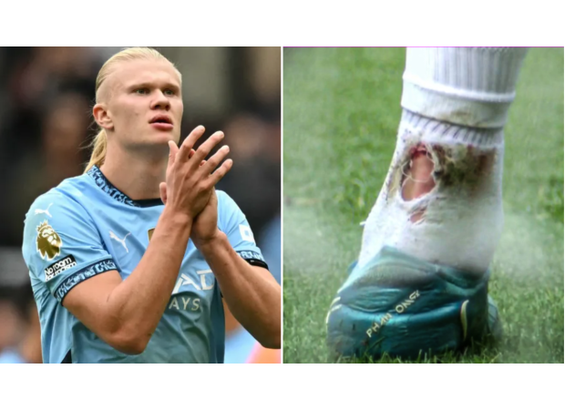 Man City manager Pep Guardiola gives an update on Erling Haaland's injury status after the striker failed to score in a recent match.