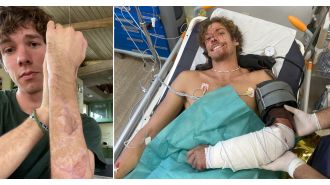 Survivor of shark attack to make earring from tooth pulled from severed arm.