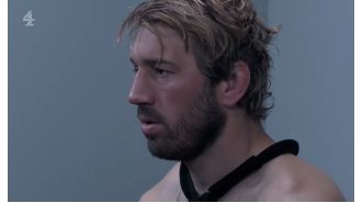 Famous SAS contestant at risk of dislocating shoulder due to severe injury.