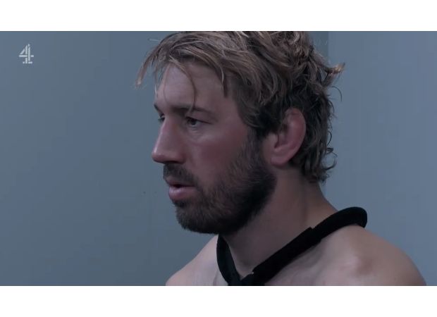 Famous SAS contestant at risk of dislocating shoulder due to severe injury.