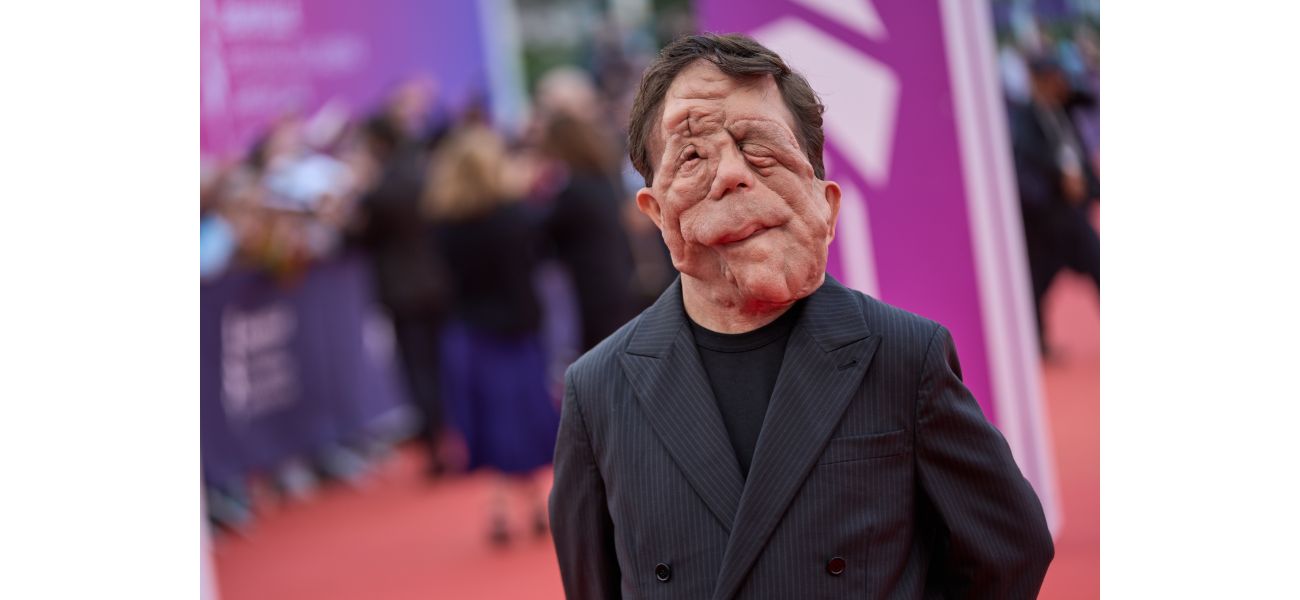 Actor Adam Pearson didn't believe disabled individuals were permitted to appear in movies, as seen in A Different Man.