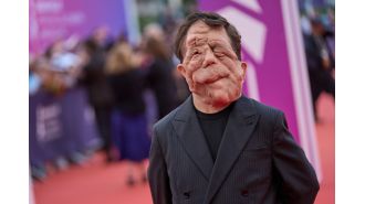 Actor Adam Pearson didn't believe disabled individuals were permitted to appear in movies, as seen in A Different Man.