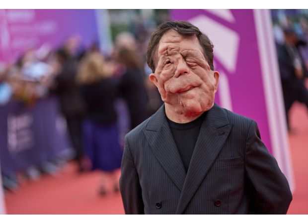 Actor Adam Pearson didn't believe disabled individuals were permitted to appear in movies, as seen in A Different Man.