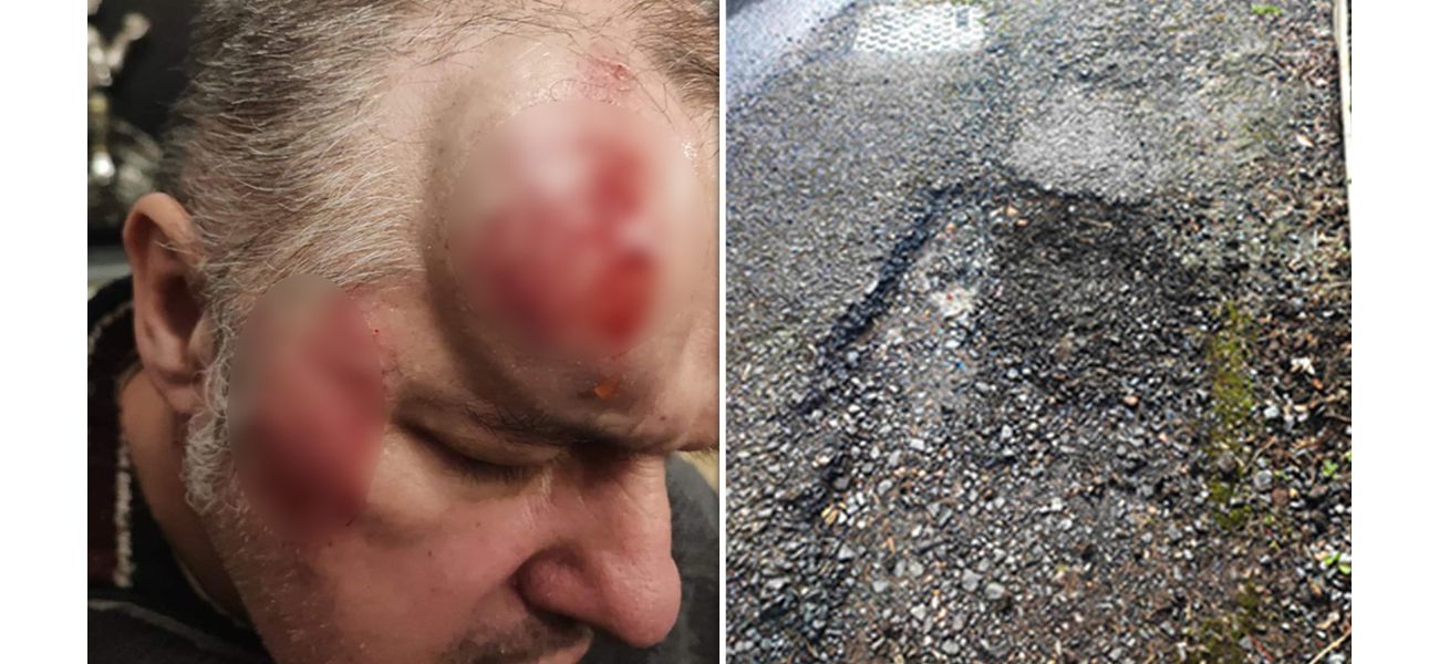 Elderly man injured severely after falling on large pothole, sustaining spinal and facial injuries.