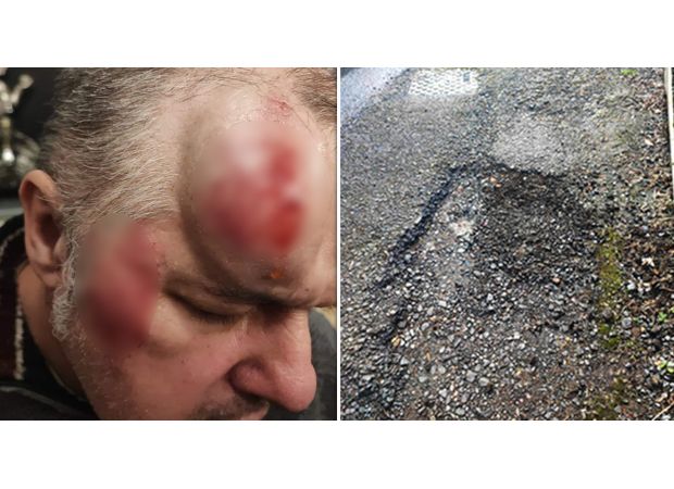 Elderly man injured severely after falling on large pothole, sustaining spinal and facial injuries.