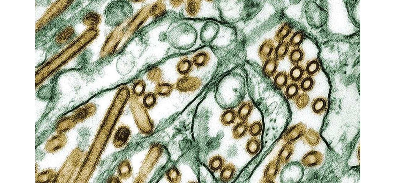 Australia invests huge amount to safeguard against lethal bird flu.