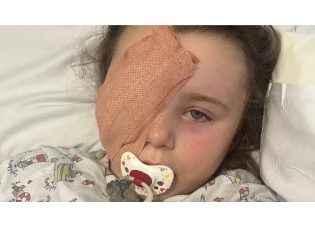 A 7-year-old girl's eye was lost when a vape battery acid exploded in her face.