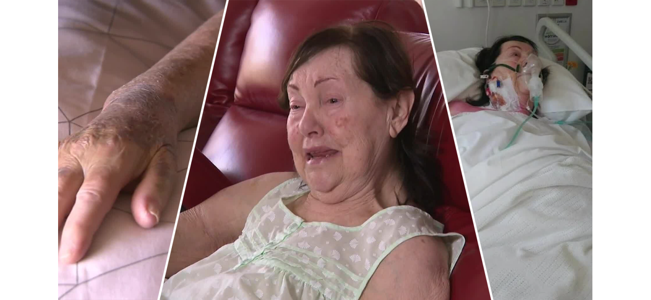 An elderly woman, traumatized, claims she was stuck in a hospital bed railing for multiple hours.