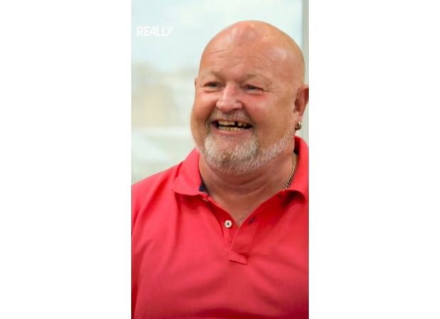 Years after being hit by a cricket ball, a man still has a 30-year-old tumour on his head.