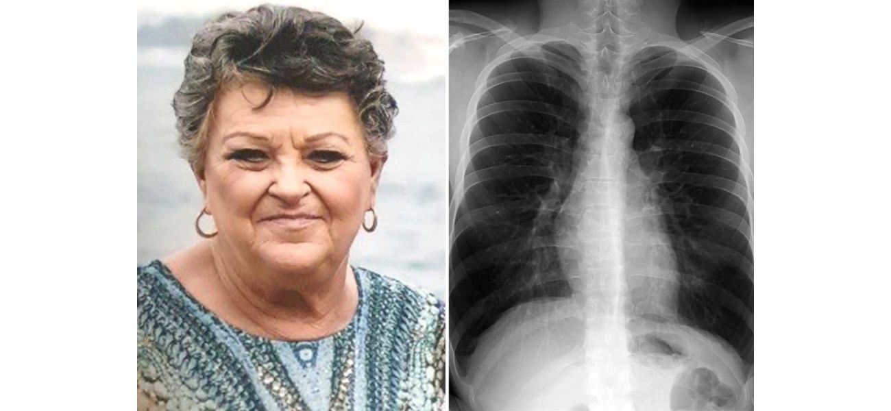 One out of 13 Australians over 40 are affected by this lung disease, but half are unaware of it.