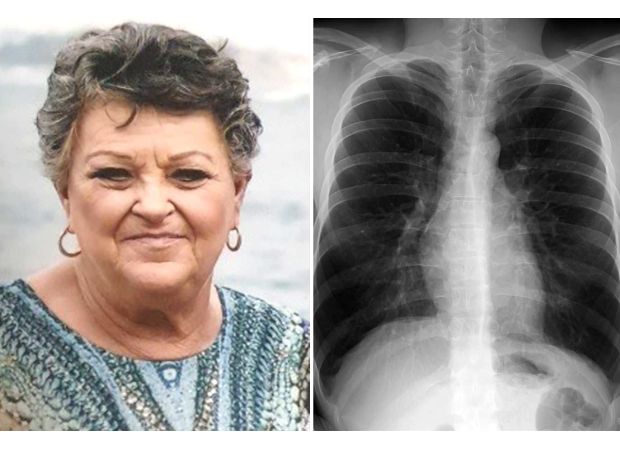 One out of 13 Australians over 40 are affected by this lung disease, but half are unaware of it.