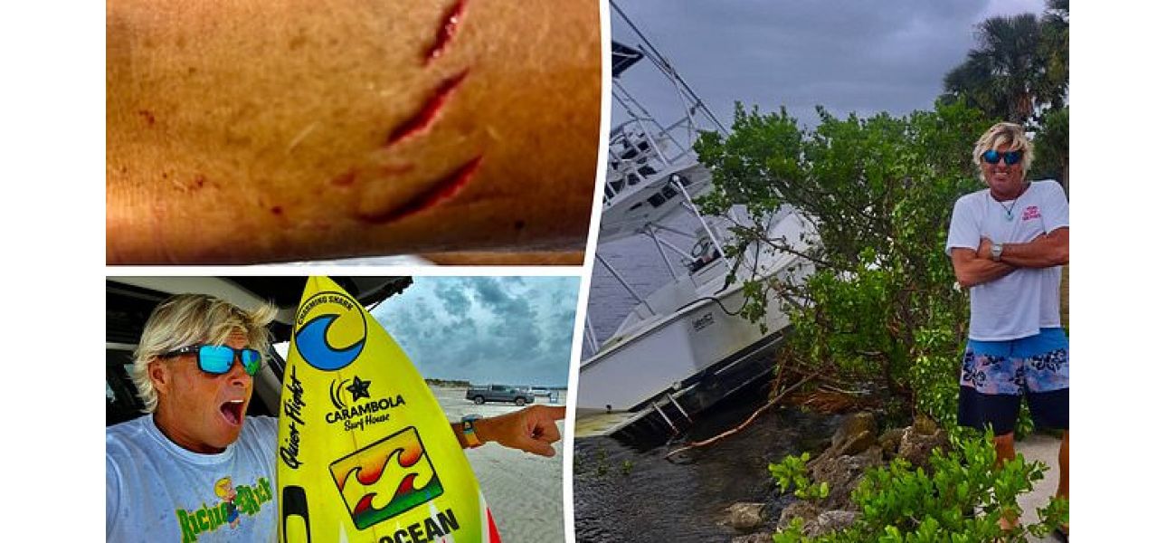 After surviving a shark attack and hurricane in just two weeks, a surfer is back in the water.