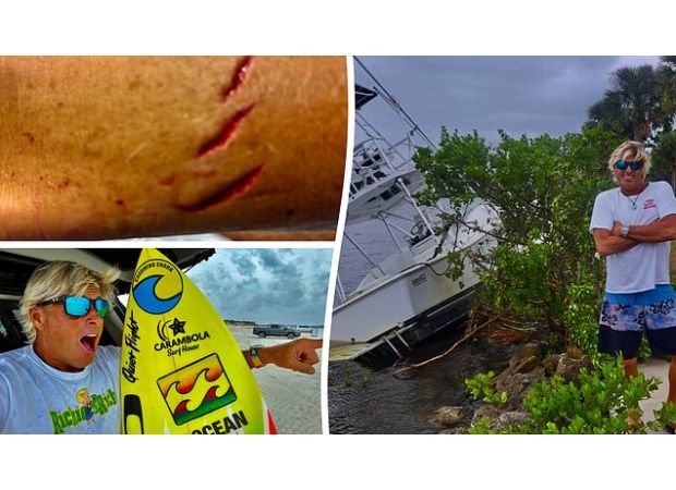 After surviving a shark attack and hurricane in just two weeks, a surfer is back in the water.