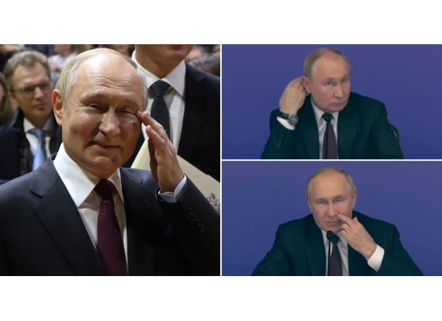 Putin experiences unexplained itching a day after Kremlin claims he is doing well.