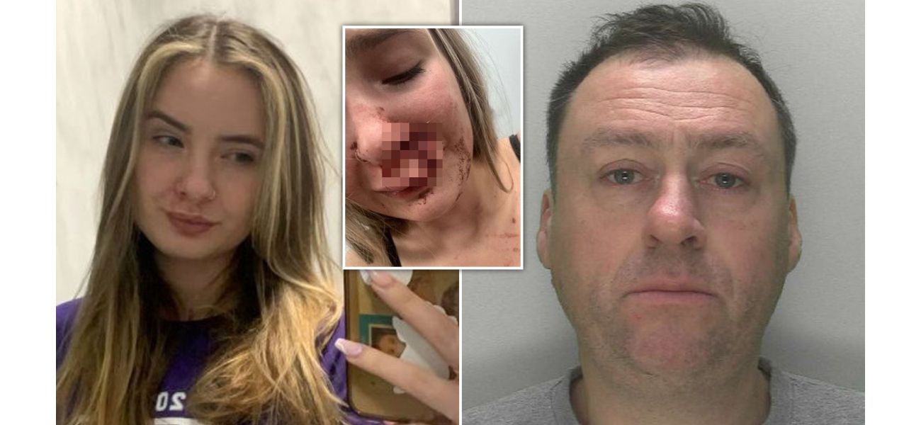 A 19-year-old girl was attacked by a stranger on a bus in front of other passengers, resulting in severe facial injuries.