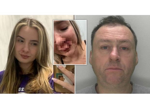 A 19-year-old girl was attacked by a stranger on a bus in front of other passengers, resulting in severe facial injuries.