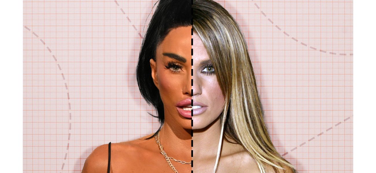 Katie Price shares unexpected results of cosmetic procedures