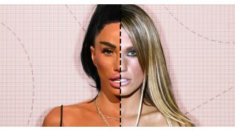 Katie Price shares unexpected results of cosmetic procedures