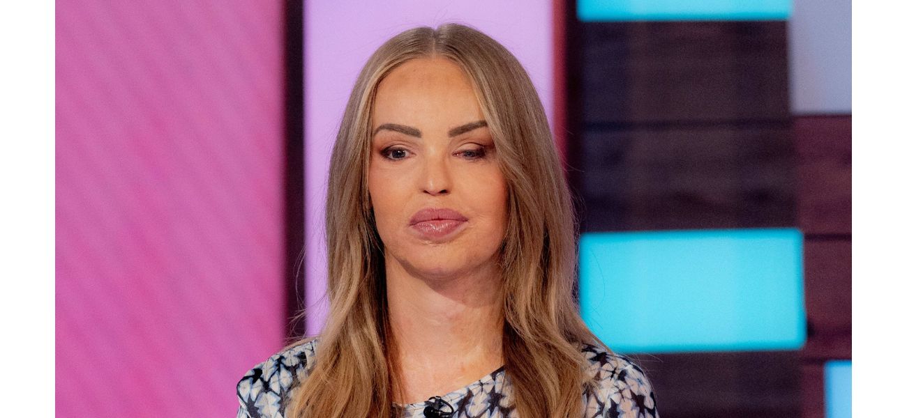 Katie Piper responds to hateful comment urging her to commit suicide.
