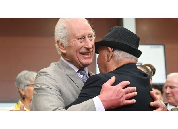 What caused King Charles to have swollen fingers?