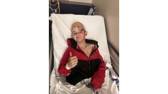 A boy underwent surgery after being brutally attacked by a kangaroo.