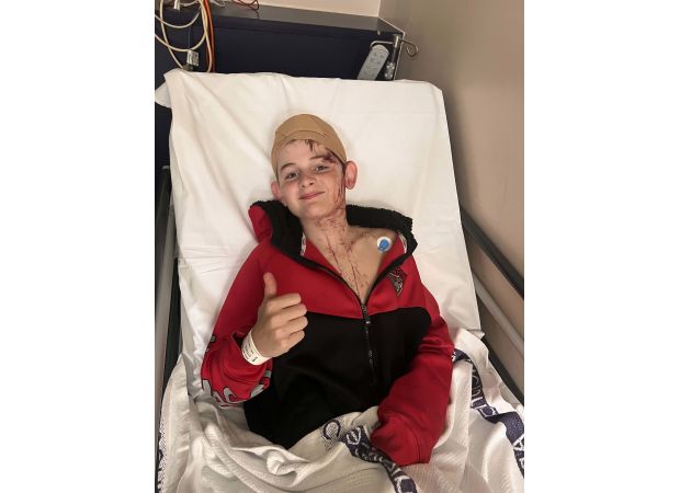 A boy underwent surgery after being brutally attacked by a kangaroo.