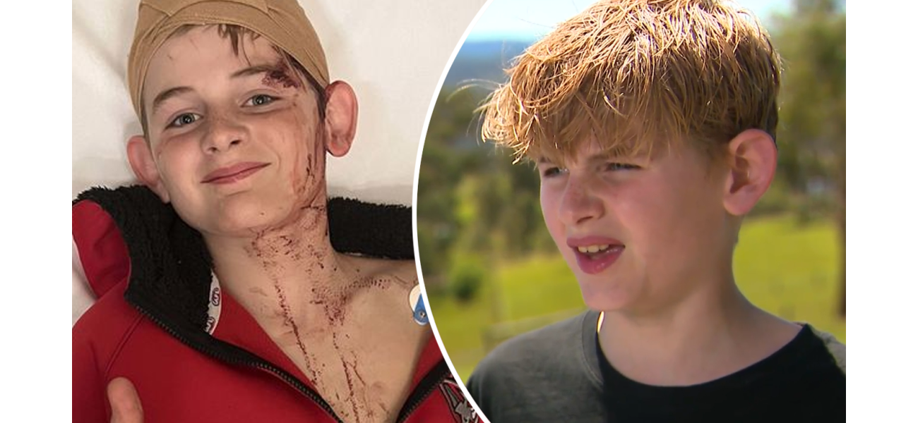 12-year-old boy left traumatized and frightened after being viciously attacked by a kangaroo.