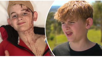 12-year-old boy left traumatized and frightened after being viciously attacked by a kangaroo.