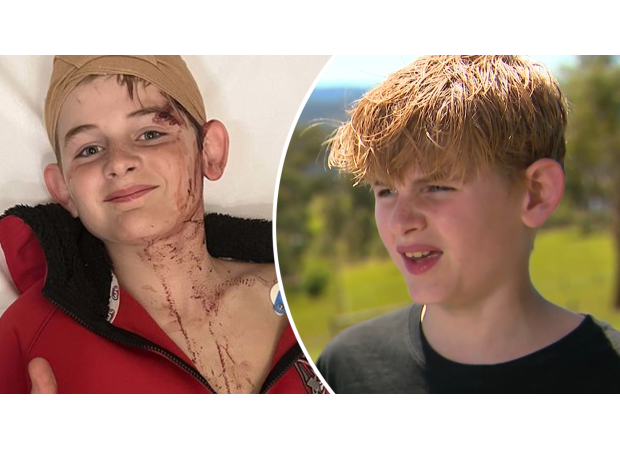 12-year-old boy left traumatized and frightened after being viciously attacked by a kangaroo.