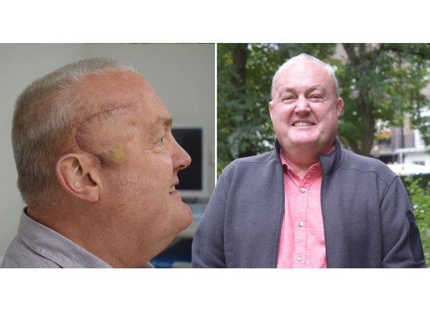 New treatment shrinks man's deadly brain tumour by half, bringing hope to patients.