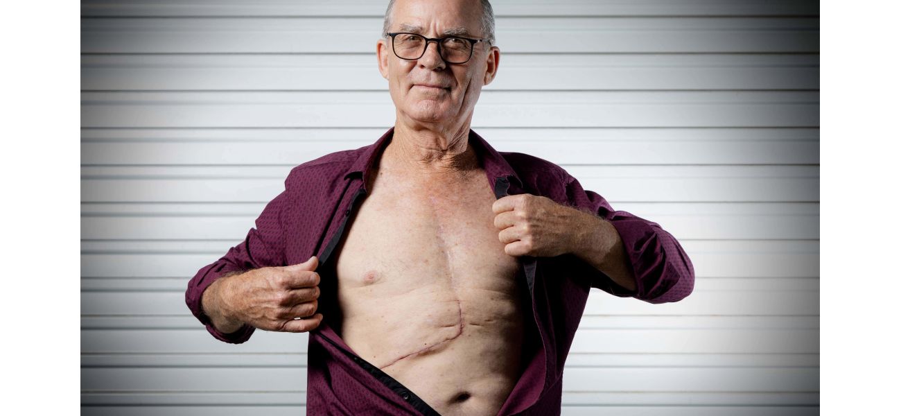 Doctor successfully removes large tumor from patient's body.
