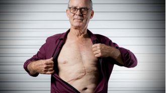 Doctor successfully removes large tumor from patient's body.