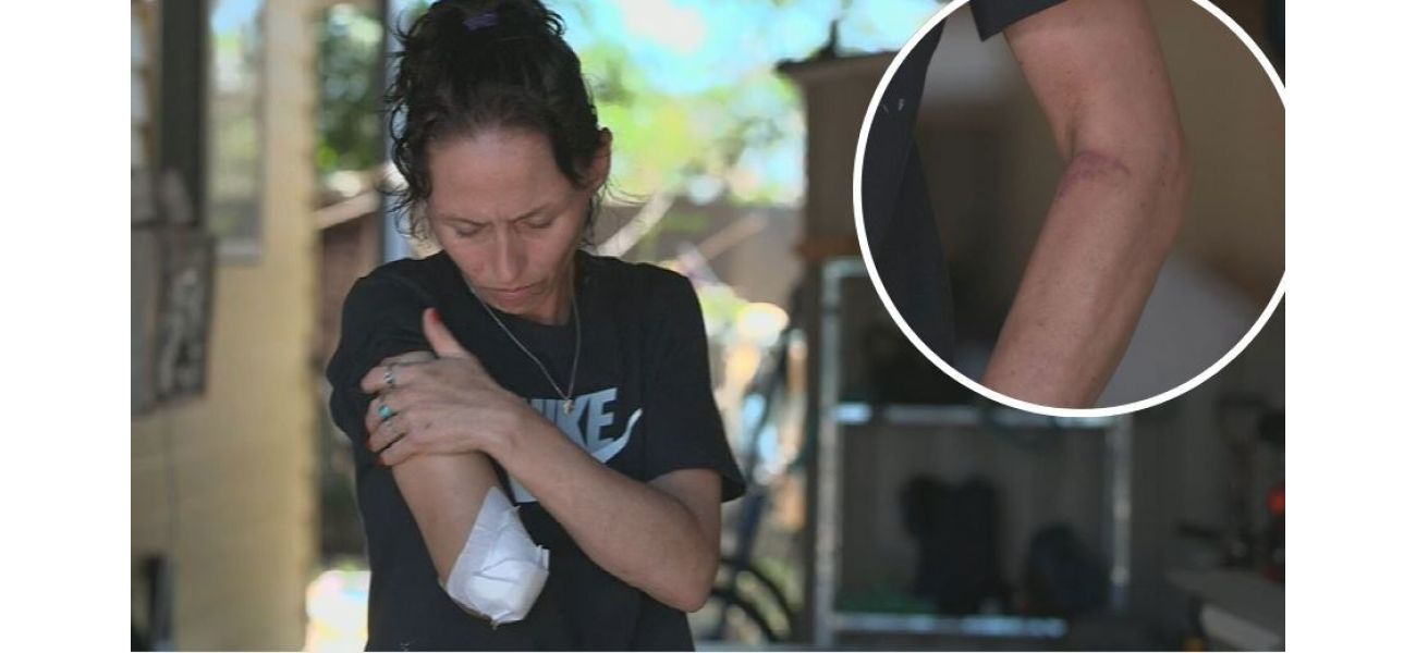 A mom in Queensland doesn't hold her dog responsible for tearing off her arm.