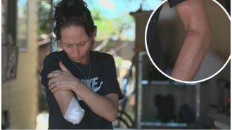 A mom in Queensland doesn't hold her dog responsible for tearing off her arm.