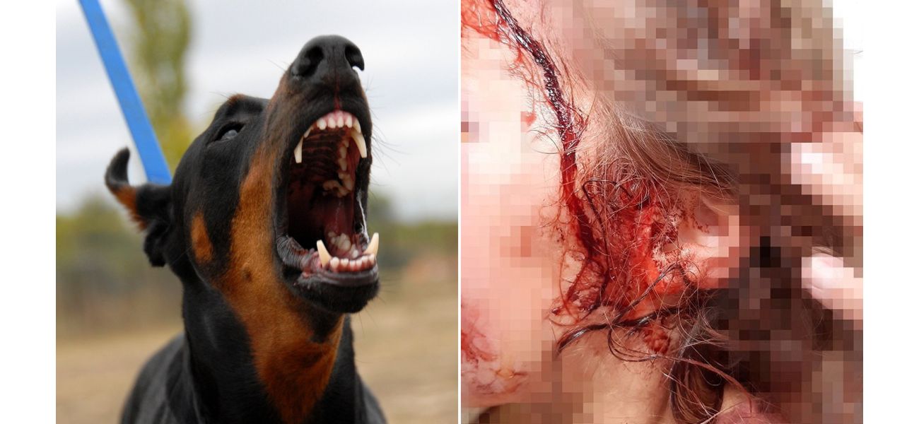 Young girl hurt badly in attack by family pet